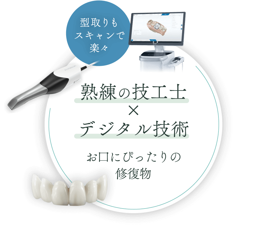 熟練の技工士×デジタル技術 お口にぴったりの修復物