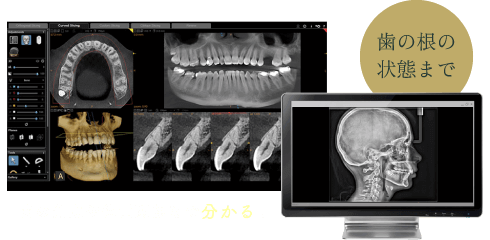 歯の角度や位置関係まで分かる！