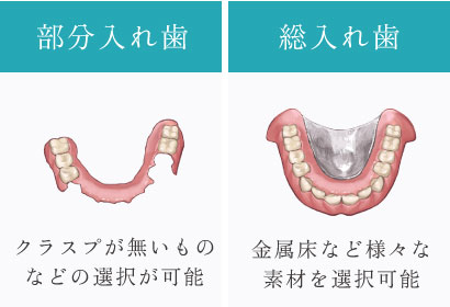 部分入れ歯：クラスプが無いものなどの選択が可能／総入れ歯：金属床など様々な素材を選択可能